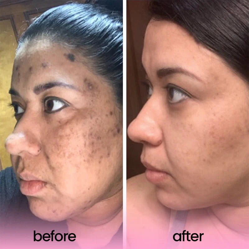 TURMERIC & KOJIC ACID PADS